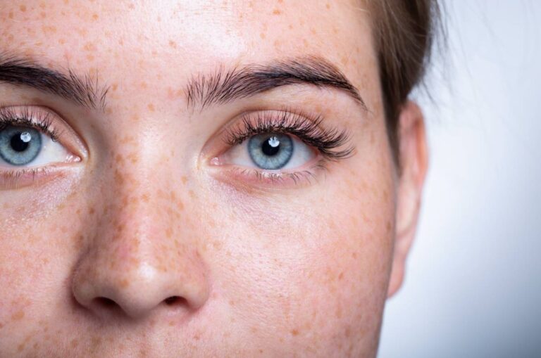 Close up of girl with freckles and blue eyes.