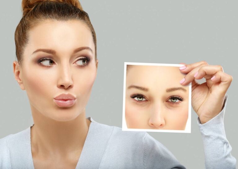 featured image for how long do blepharoplasty results last